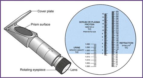 refractometer sop urinalysis|refractive index of urine test.